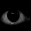 the eye