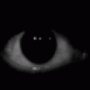 the eye